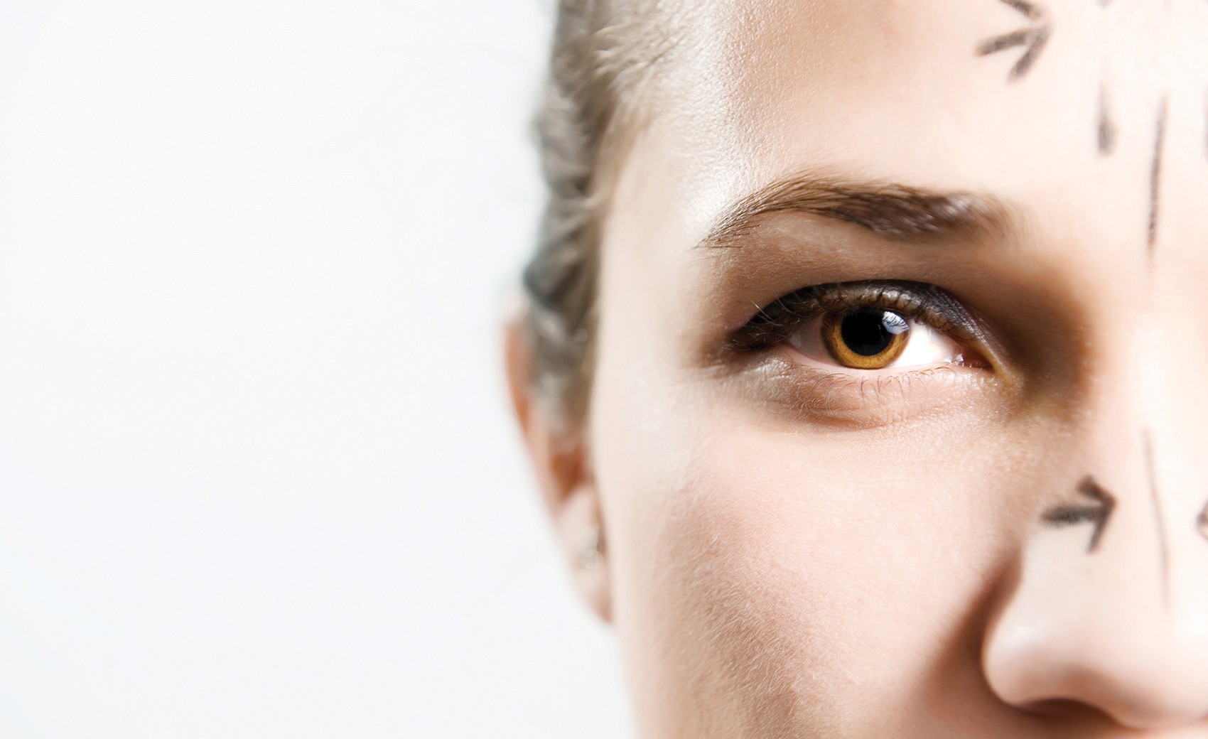 Ρινοπλαστική