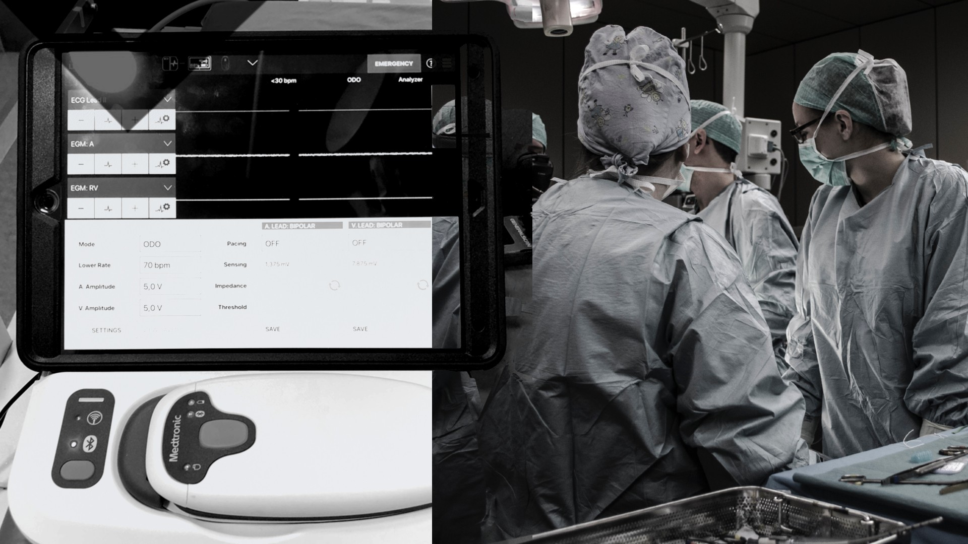 ΑΓΙΟΣ ΛΟΥΚΑΣ: Νέας τεχνολογίας βηματοδότες σε Έλληνες ασθενείς