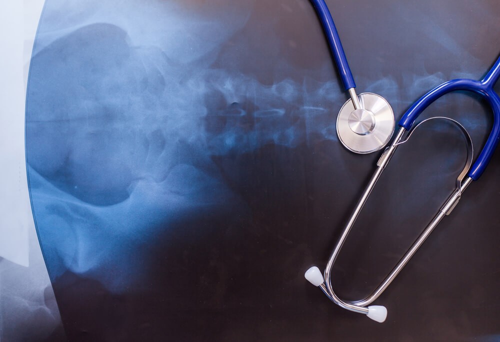 ΑΓΙΟΣ ΛΟΥΚΑΣ ΟΣΤΕΟΠΟΡΩΣΗ ΔΉΜΗΤΡΑ ΜΠΟΓΔΑΝΟΥ