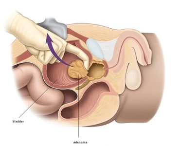 Euromedica Γενική κλινική Γραμμένος