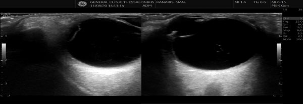 Λευκόπουλος Υπέρηχοι