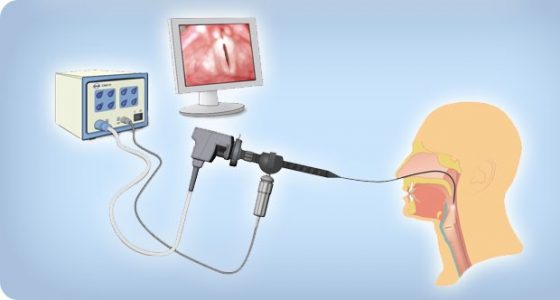 Εξοπλισμός για την ενδοσκοπική μελέτη κατάποσης