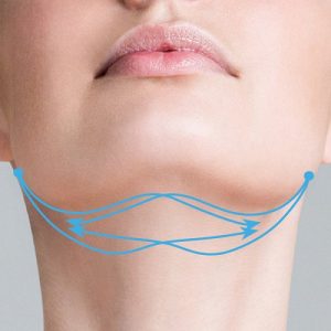 νήματα προσώπου Δρ Παπαιωάννου