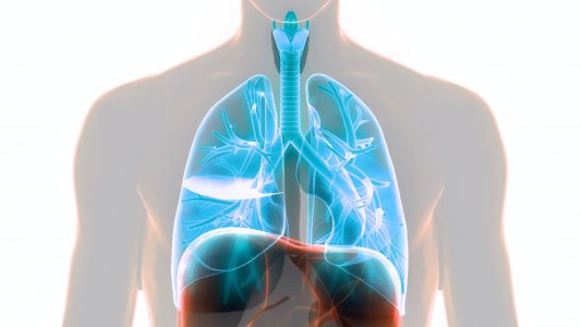 αξονική τομογραφία