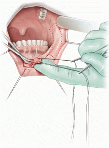 επανορθωτική ανδρολογία