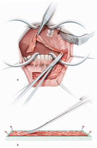 επανορθωτική ανδρολογία