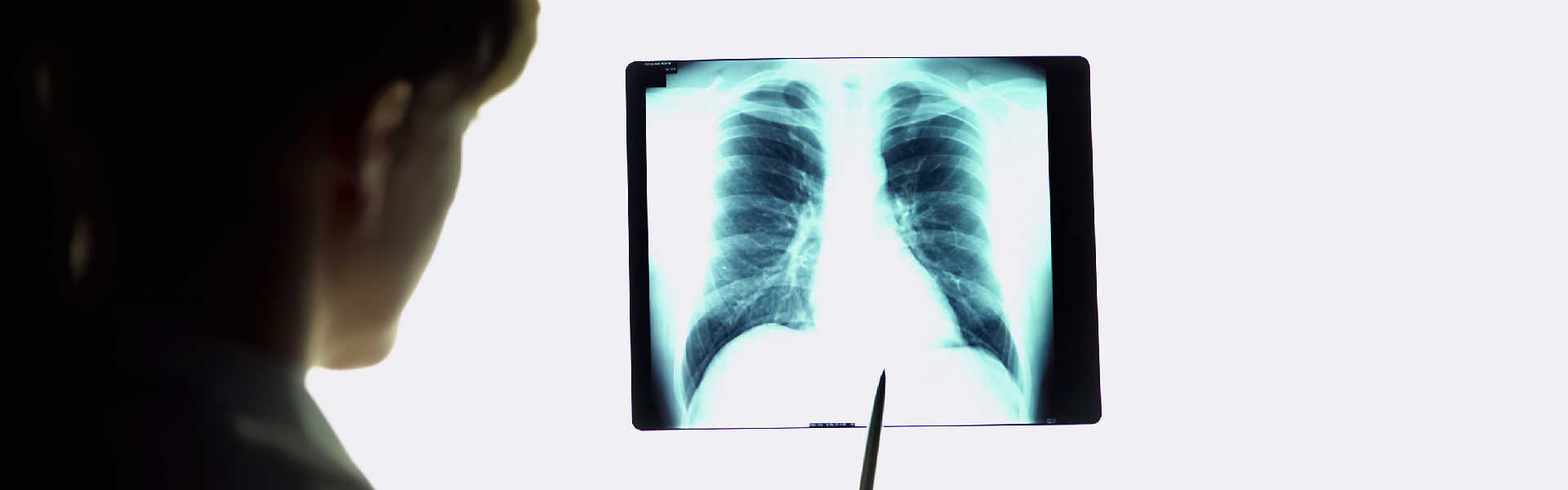 Κρυοβιοψία