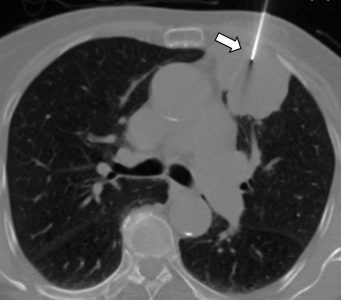 Ακτινολογία