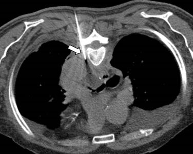 Ακτινολογία