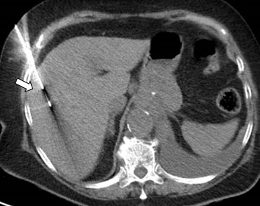 Ακτινολογία