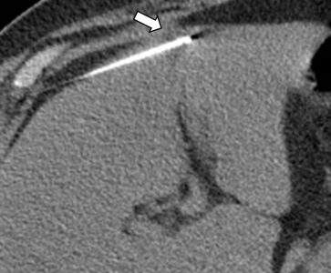 Ακτινολογία