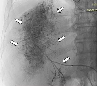 Ακτινολογία