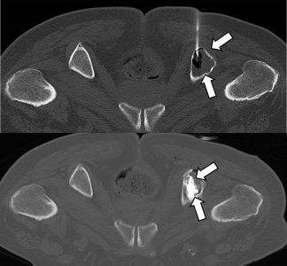 Ακτινολογία