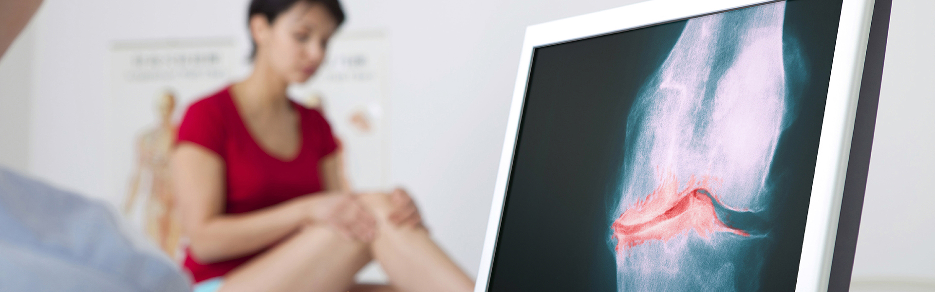 αρθροπλαστική