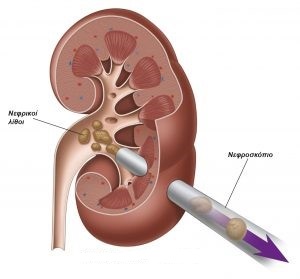 Διαδερμική