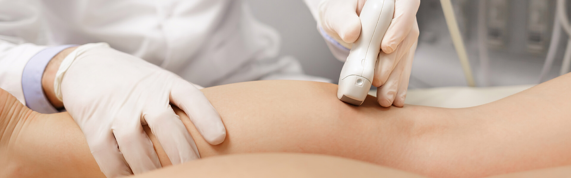 ευρυαγγείες