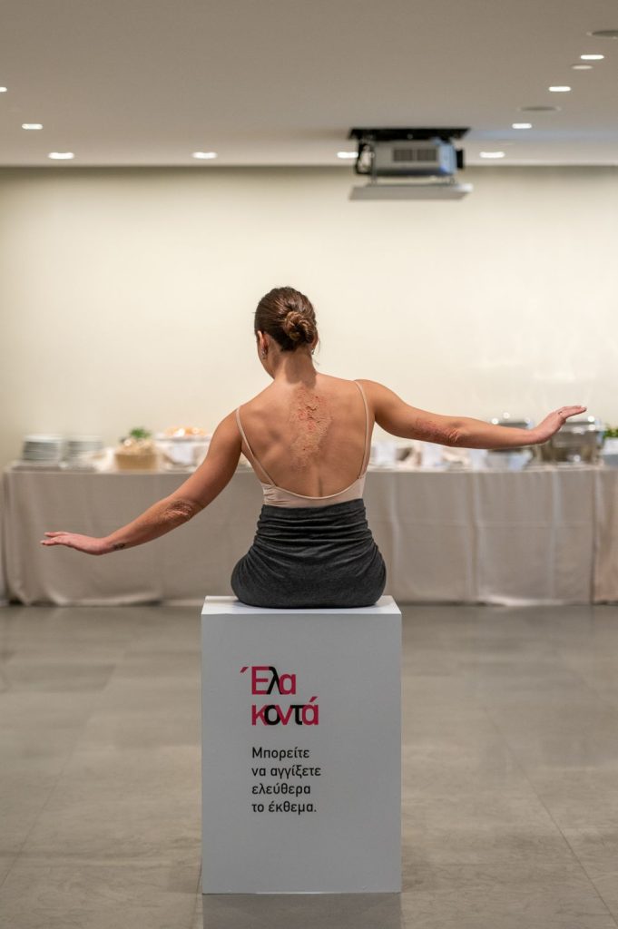 «Έλα Κοντά»: Όταν είσαι ενημερωμένος για την ψωρίαση, δεν φοβάσαι να έρθεις κοντά