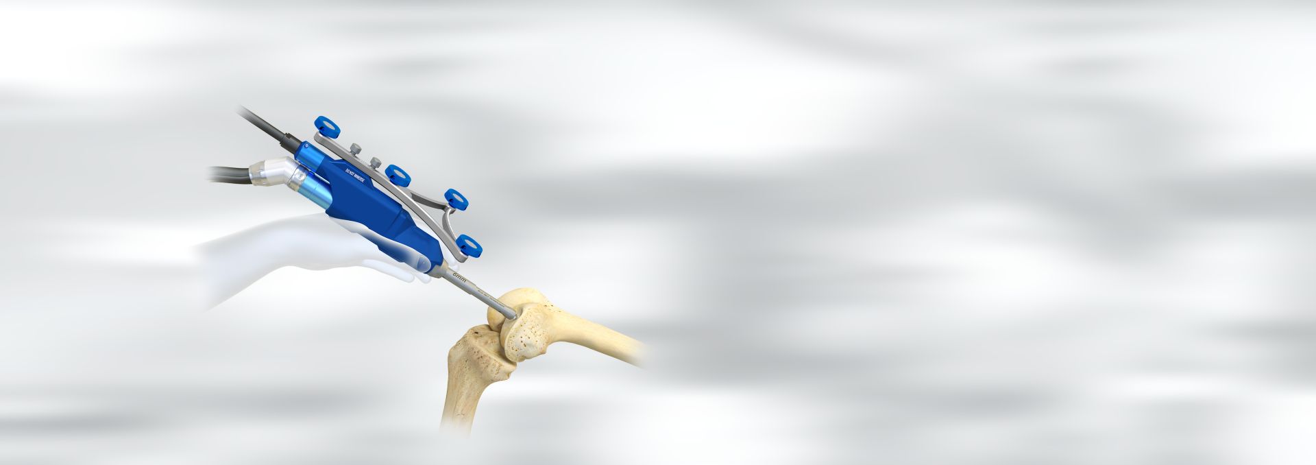 Ρομποτική Αρθροπλαστική