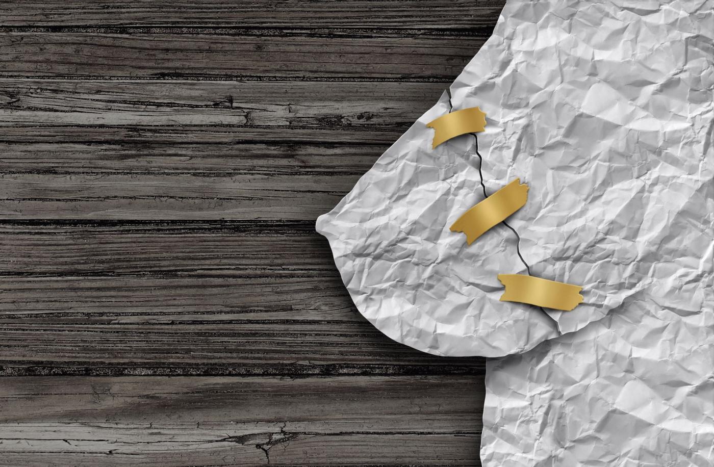 Μαστεκτομή ή Ογκεκτομή στον Καρκίνο του Μαστού;